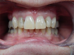 Before and After Photos Patient 55297 After Photo # 2