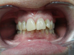 Before and After Photos Patient 55297 Before Photo # 1